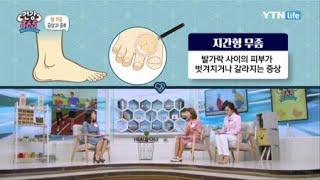 발, 발톱 무좀 증상과 종류 / YTN 라이프