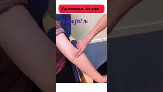 Pulse Points#Sites for taking Pulse