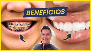 10 Benefícios SURPREENDENTES de um Tratamento Ortodôntico!