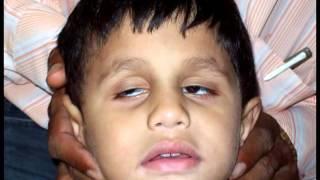 TREATMENT OF 6 EYES INCURABLE DISEASES OF WORLD Dr RISHABH JAIN +91-9425092329  UJJAIN  [M.P.] INDIA