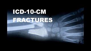 ICD-10-CM Coding for Fractures