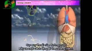 Chữa bệnh mất ngủ như thế nào - 090.245.3079 Hằng