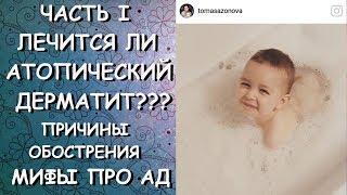 ЛЕЧИТСЯ ли АТОПИЧЕСКИЙ ДЕРМАТИТ?/ МИФЫ ПРО АД/ПРИЧИНЫ/ОБОСТРЕНИЯ