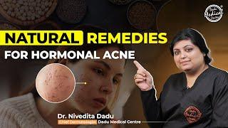 Natural Treatment for Hormonal Acne by Dermatologist | Acne Treatment In Delhi | Dr. Nivedita Dadu