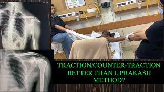 Traction/Counter-traction better than the L Prakash /[External rotation] method ?