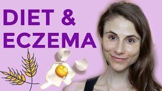 DIET & SUPPLEMENTS FOR ECZEMA: Q&A WITH DERMATOLOGIST DR DRAY