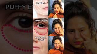 ️Antiaging glowingskin yoga reduce nasolabial fold,puffyeyes,facelift, smile lineit daily#shorts