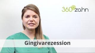 Gingivarezession - Was bedeutet Gingivarezession? | Dental-Lexikon | 360°zahn