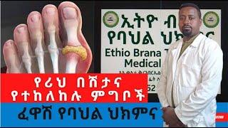 የሪህ በሽታና ፈፅሞ የተከለከሉ ምግቦች | ፈዋሽ የባህል ህክምና  | ኢትዮ ብራና የባህል ህክምና | #sub #gout #traditionalmedicine #dr