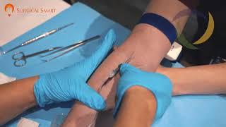 Venipuncture procedure for prf