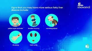 Fatty Liver, Causes, Signs and Symptoms, Diagnosis and Treatment.