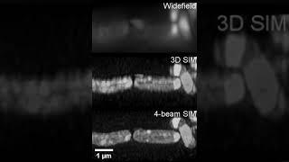 3D projections of live vegetative B subtilis - widefield, 3D SIM and 4-Beam SIM