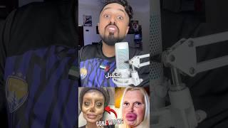 افشل عمليات تجميل في التاريخ ! #عجائب #معلومات #حقائق #هلتعلم #عملية_التجميل