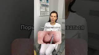 Как избавиться от черных точек на носу  рассказываю в inst tatimore_beauty