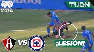 ¡DURA BAJA PARA ATLAS! Barbosa se lesiona | Atlas 1-1 Cruz Azul | Supercopa Mx 2022 | TUDN