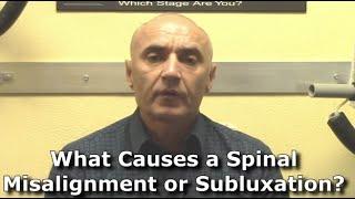 What Causes A Spinal Misalignment | Burlington Ontario