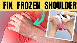 5 Exercises for Frozen Shoulder you can Do at Home | Doc Cherry