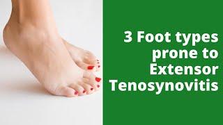 3 Foot types prone to Extensor Tenosynovitis