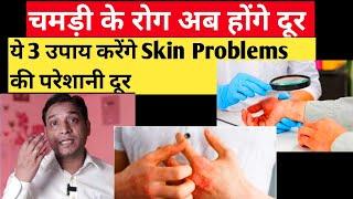 चमड़ी के रोग के कारण और उपाय | Factors Behind Skin Problems With Effective #remedies #lalkitab