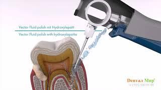 Применение аппарата Вектор при лечении пародонтита, пародонтоза, переимплантита. Дентал Мир