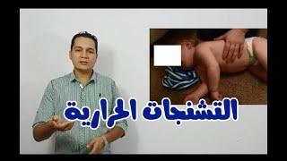 التشنجات الحرارية عند الاطفال  FEBRILE CONVULTIONS