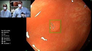 Medtronic GI Genius AI system for colonscopy - live demonstration. Andreas Müller