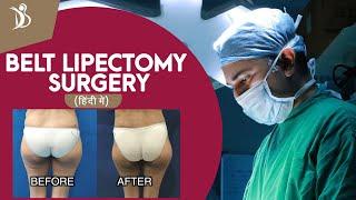 Belt Lipectomy Surgery Details | What is a Belt Lipectomy? | Best Plastic Surgeon in Mumbai