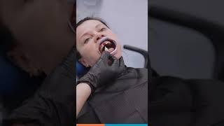 Установка переднего зуба на имплантате / Кейс