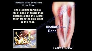 Iliotibial Band Syndrome Of The Knee - Everything You Need To Know - Dr. Nabil Ebraheim