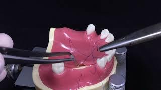 Horizontal External Mattress suture #9 - Back to the suture