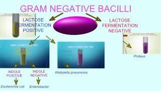 FLOWCHART OF BACTERIAL TESTS: GRAM NEGATIVE BACILLI