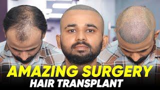 Hair Transplant in Gurgaon | Best Results & Cost of Hair Transplant in Gurgaon