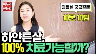 튼살치료전 확인하세요! 하얀 튼살 치료횟수?, 치료시 통증은 얼마나?, 튼살치료후 부작용은?