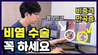 이런분은 비염수술 꼭 하세요