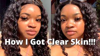 Do This Routine for Clear Skin!!!