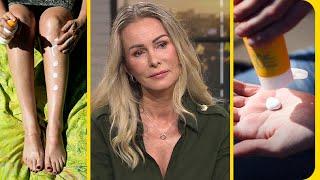 Tar död på myter om solskydd: ”Det viktigaste är att du använder de… | Nyhetsmorgon | TV4 & TV4 Play