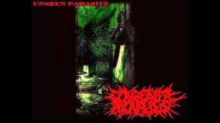 CONGENITAL ANOMALIES - Unseen Parasite