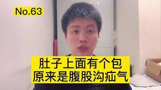 疝气是因为肚子里有气？没那么简单！医生用视频告诉你什么是疝气【普外科曾医生】