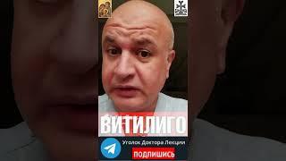 Что такое Витилиго (лейкодерма)? Анонс лекции