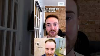 Patient Testimonial | Hair Transplant Patient Review | Chandra Hair Clinic #ytshorts