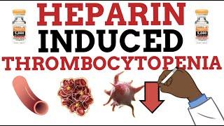 Heparin Induced Thrombocytopenia (HIT) MADE EASY