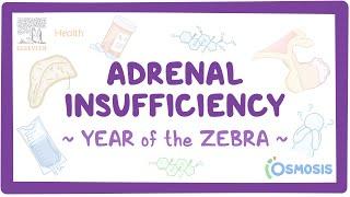 Adrenal insufficiency (Year of the Zebra)