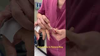 Why every hand surgeon should carry dental floss! Part 2 (Ring Removal with Dental Floss)