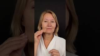  Фейслифтинг. Лобно-височный лифтинг. Доктор ФРОЛОВ МИХАИЛ МИХАЙЛОВИЧ.
