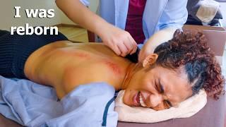 ASMR: INTENSE Chinese Back Guasha Massage with EYE Moxibustion and STEAM Therapy