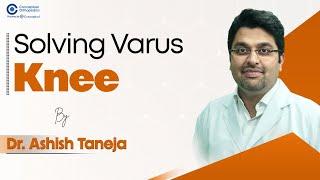 Solving Varus Knee by Dr. Ashish Taneja | Orthopedic Residency | Conceptual Orthopedic