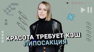 Липосакция: самая опасная операция в пластической хирургии? Опыт звезд и мнение врачей