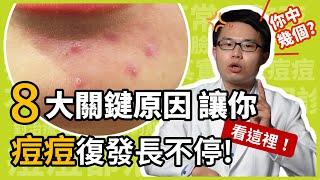 8大關鍵原因，讓你痘痘復發長不停！皮膚科楊省三醫師點出青春痘的治療重點！