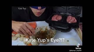 Kate Yup’s eye?