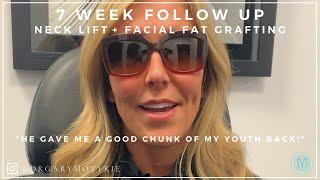 7 WEEK FOLLOW UP:  NECK LIFT + FACIAL FAT GRAFTING